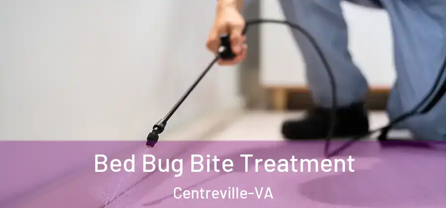  Bed Bug Bite Treatment Centreville-VA